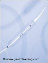 RigiflexII achalasia dilatation balloon: Courtesy Boston Scientific