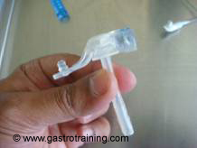 16 French 3cm Corflo cuBBy PEG- low profile gastrostomy tube