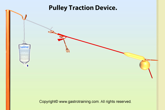 Pulley Traction