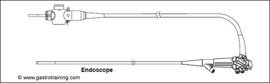 Olympus endoscope: Courtesy Olympus