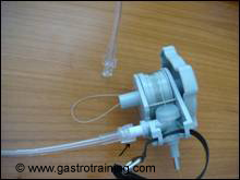 Showing the attachment of the irrigation catheter