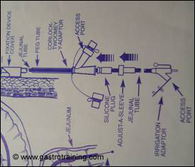 Sequence of attachments: Courtesy Merck Serono