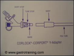 The CORLOCK-CORPORT Y Adaptor : Courtesy Merck Serono
